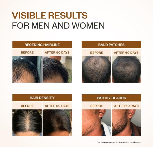 Bare Anatomy Advanced Hair Growth Serum 30ml