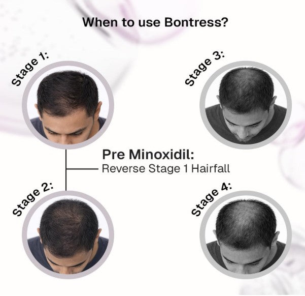 Glenmark Bontress Pro+ Scalp Serum 60ml