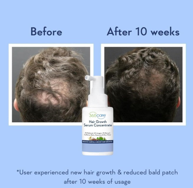 Wishcare Hair Growth Serum Concentrate 30ml
